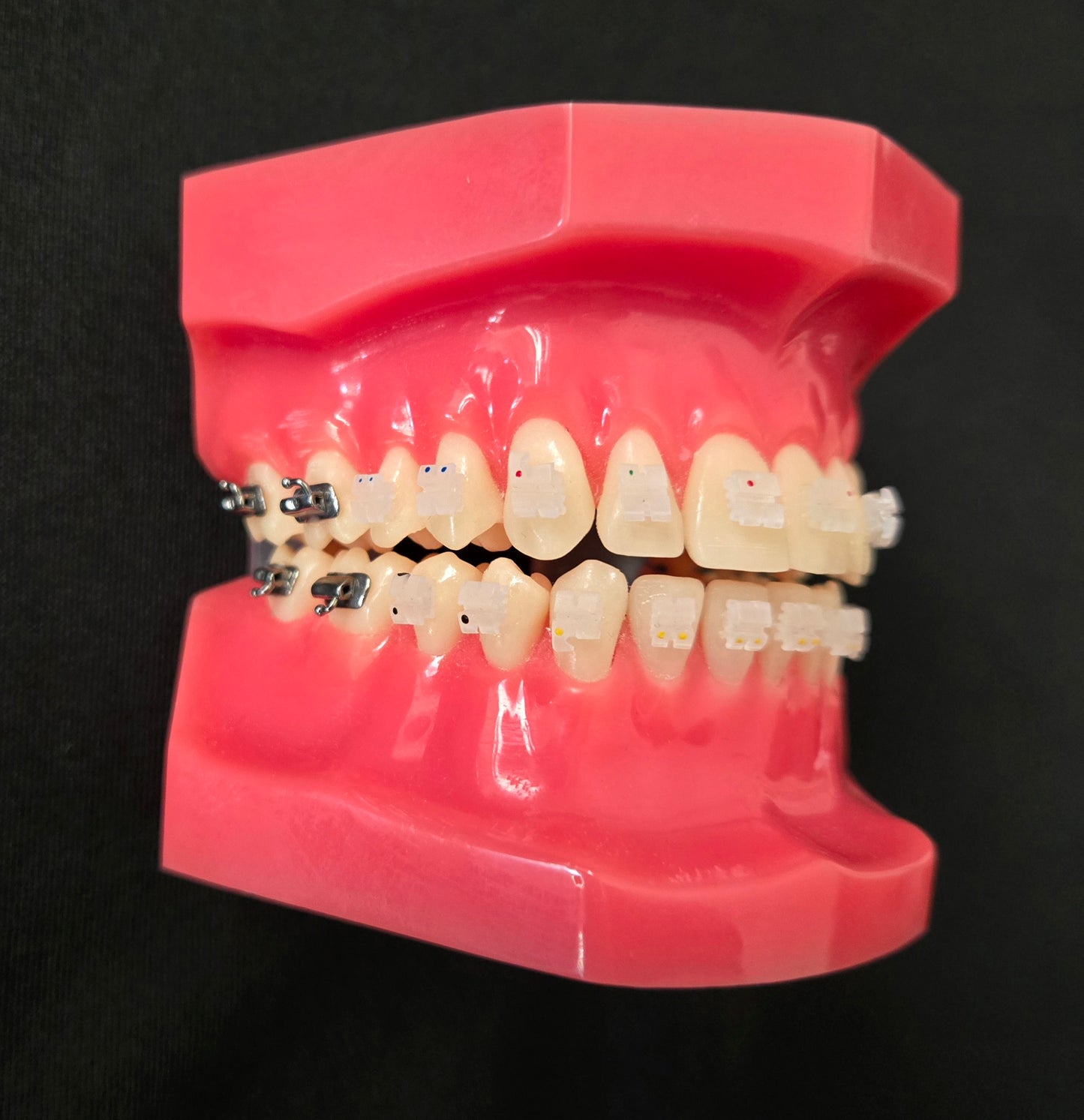 CX Ceramic .022 Roth Brackets Hooks 3's