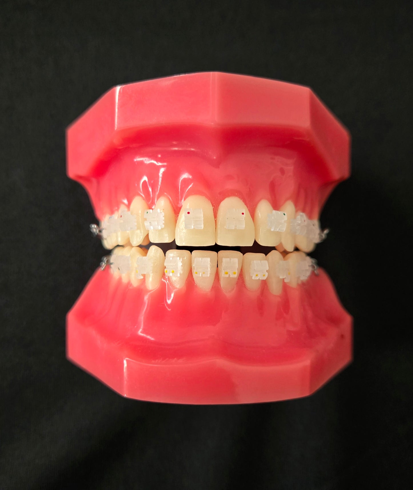 CX Ceramic .018 Roth Brackets Hooks 3's
