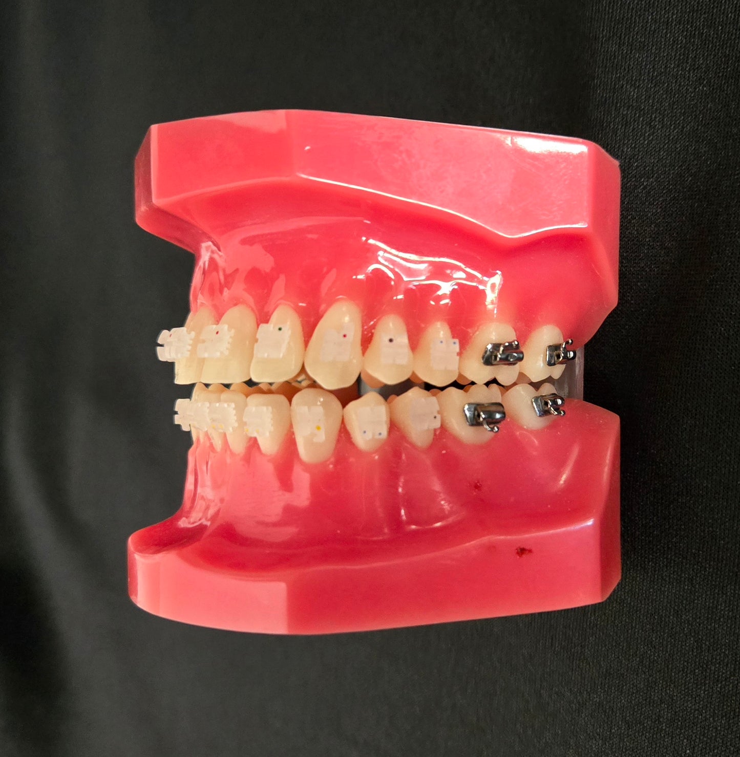 CX Ceramic .018 Roth Brackets Hooks 3's