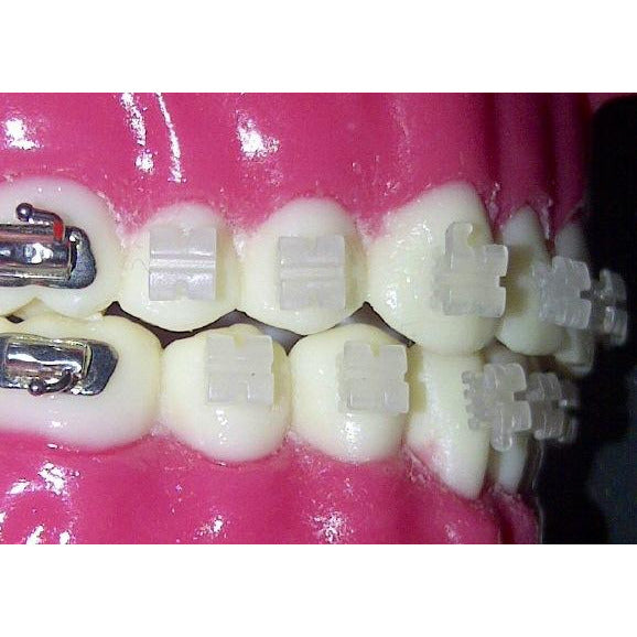 CX Ceramic .022 Roth Brackets Hooks 3,4,5's – Cx Orthodontic Supply